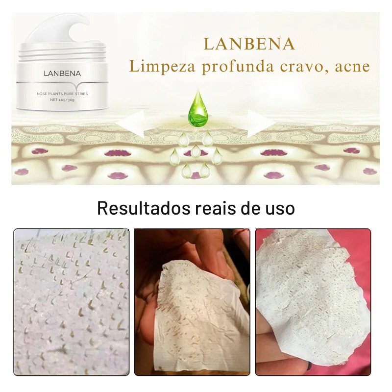 Máscara de Limpeza Nasal com Aloe Vera - Remova Cravos e Acnes com Eficácia Lanb