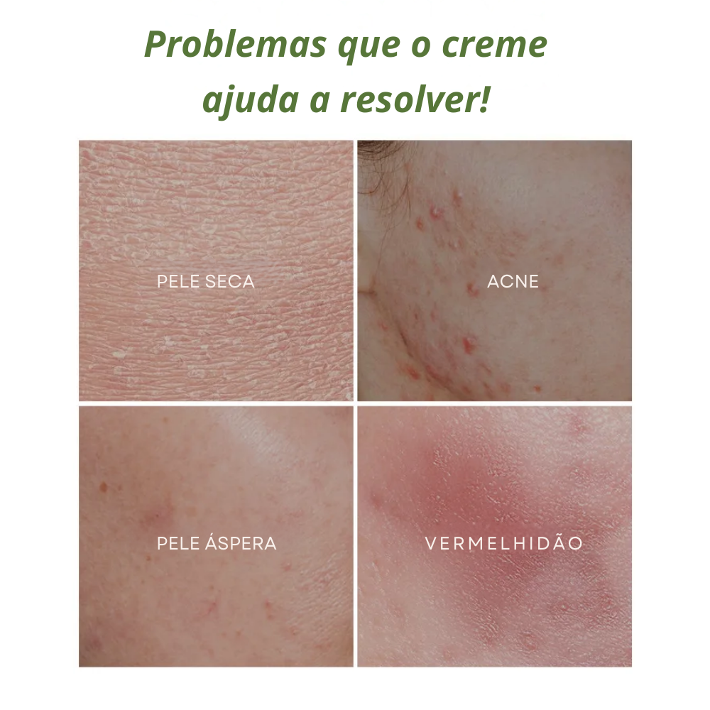 Creme Facial Hidratante Anti-Envelhecimento de Chá Verde Natural