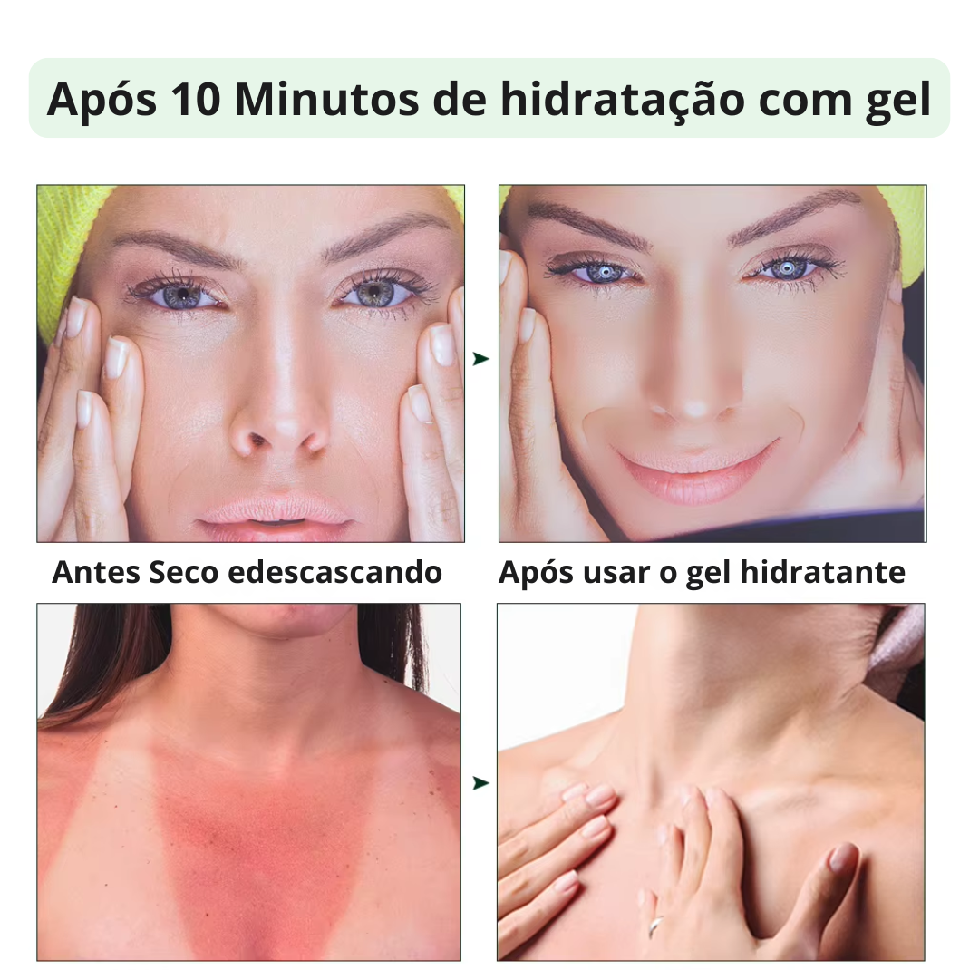 Gel Calmante Natural de Aloe Vera - Hidratação Profunda e Controle de Oleosidade