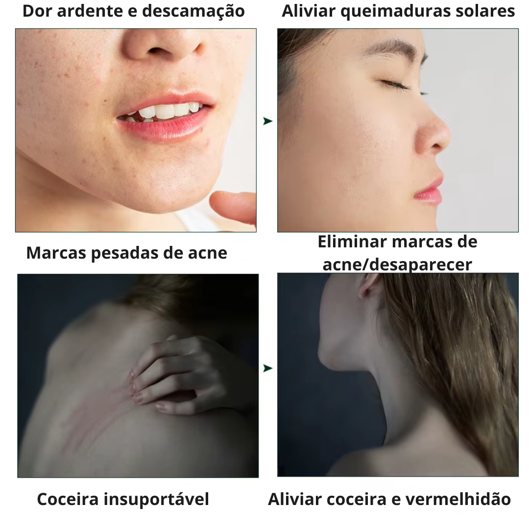 Gel Calmante Natural de Aloe Vera - Hidratação Profunda e Controle de Oleosidade