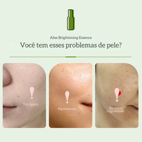 ALODERMA Natural Aloe Clareamento Soro Ilumina Tom De Pele com Nicotinamida