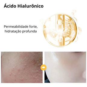 Sérum Ouro 24K Anti-envelhecimento com Ácido Hialurônico